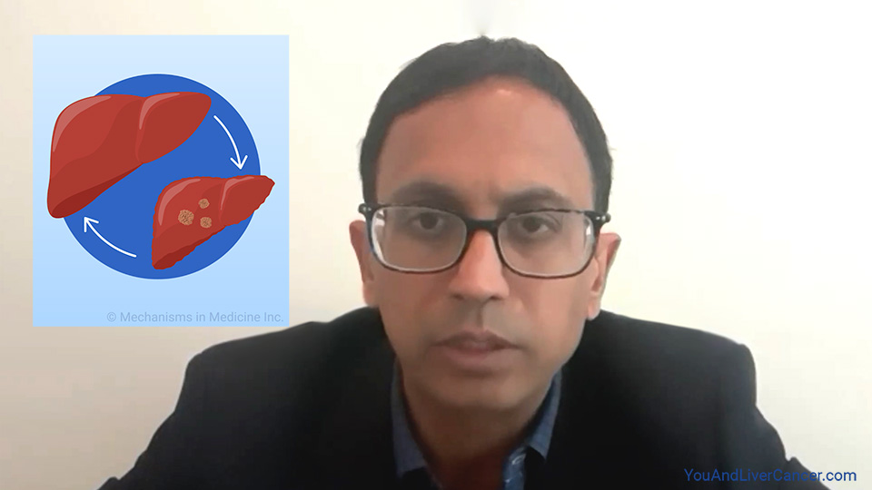 How should I prepare for liver transplant? What should I expect? 